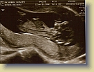 Week12-Ultrasound-01Aug2011 (3) * 3069 x 2297 * (4.74MB)